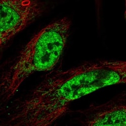 CWC15 Antibody, Novus Biologicals 0.1mL; Unlabeled:Antibodies, Polyclonal